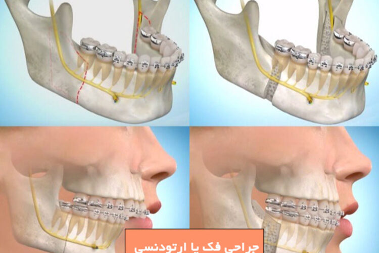 جراحی فک یا ارتودنسی