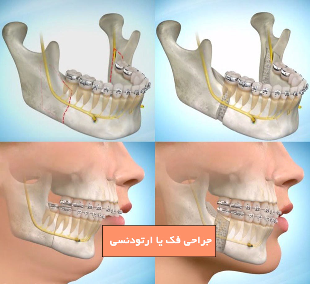 جراحی فک یا ارتودنسی